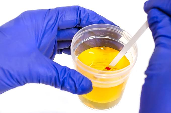 SAP 10-Panel Urine Drug Test